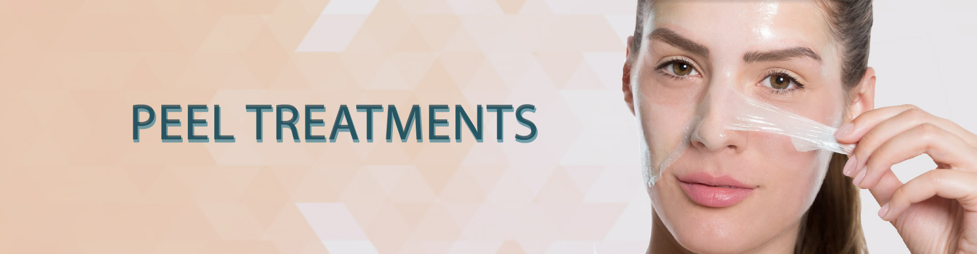 banner peel