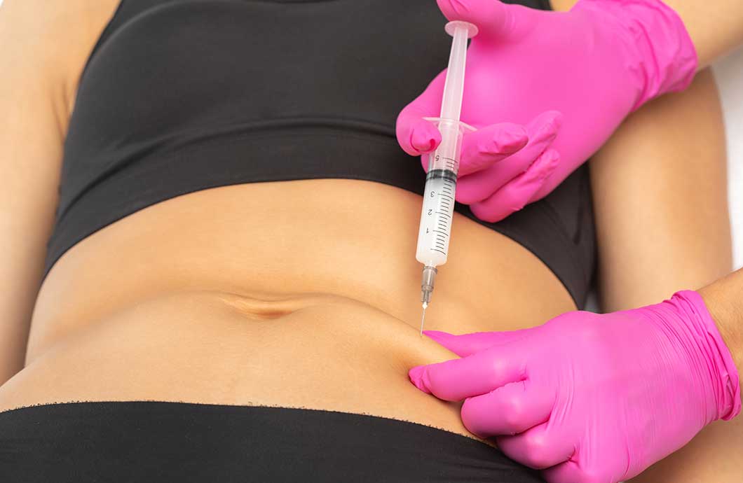 Achieving a Flatter Stomach with Lipolysis Injections