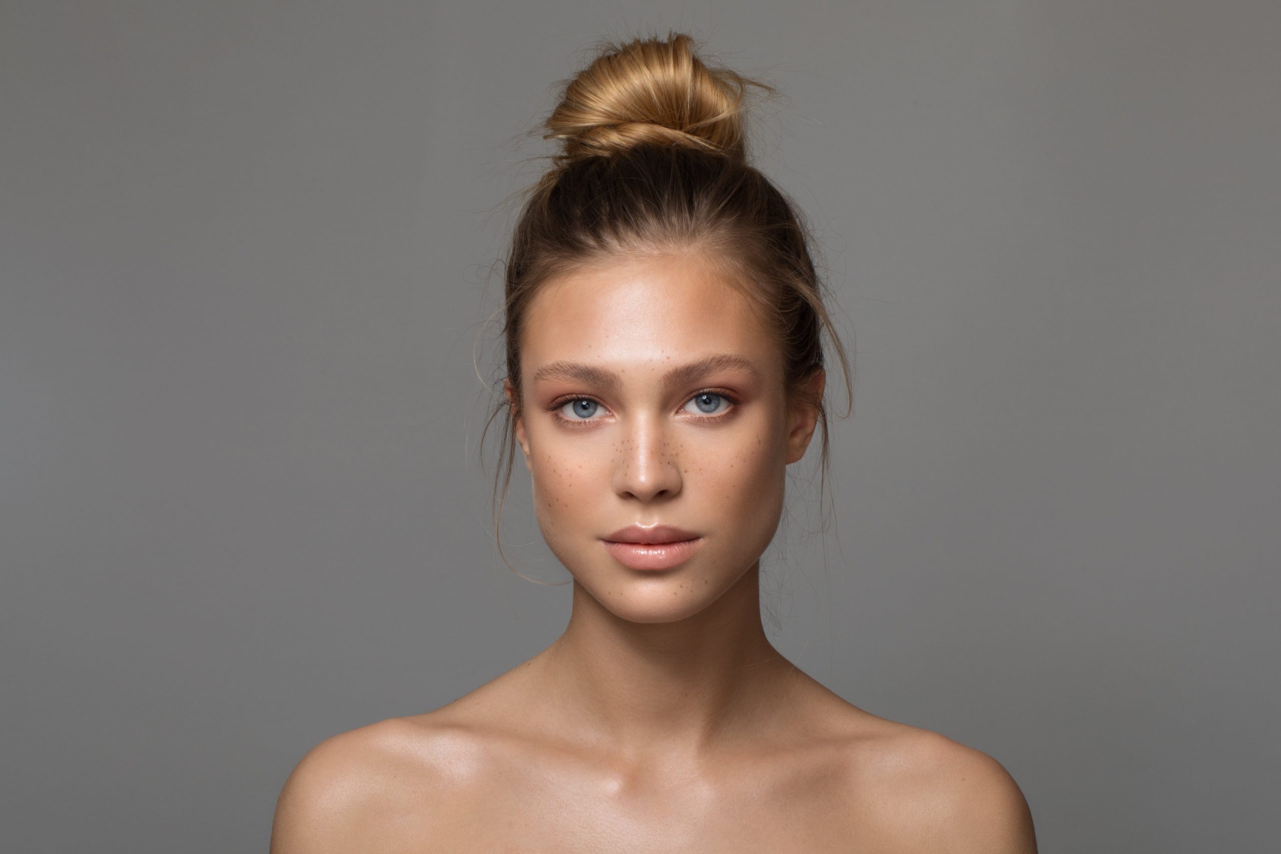 hyperpigmentation 1 min scaled