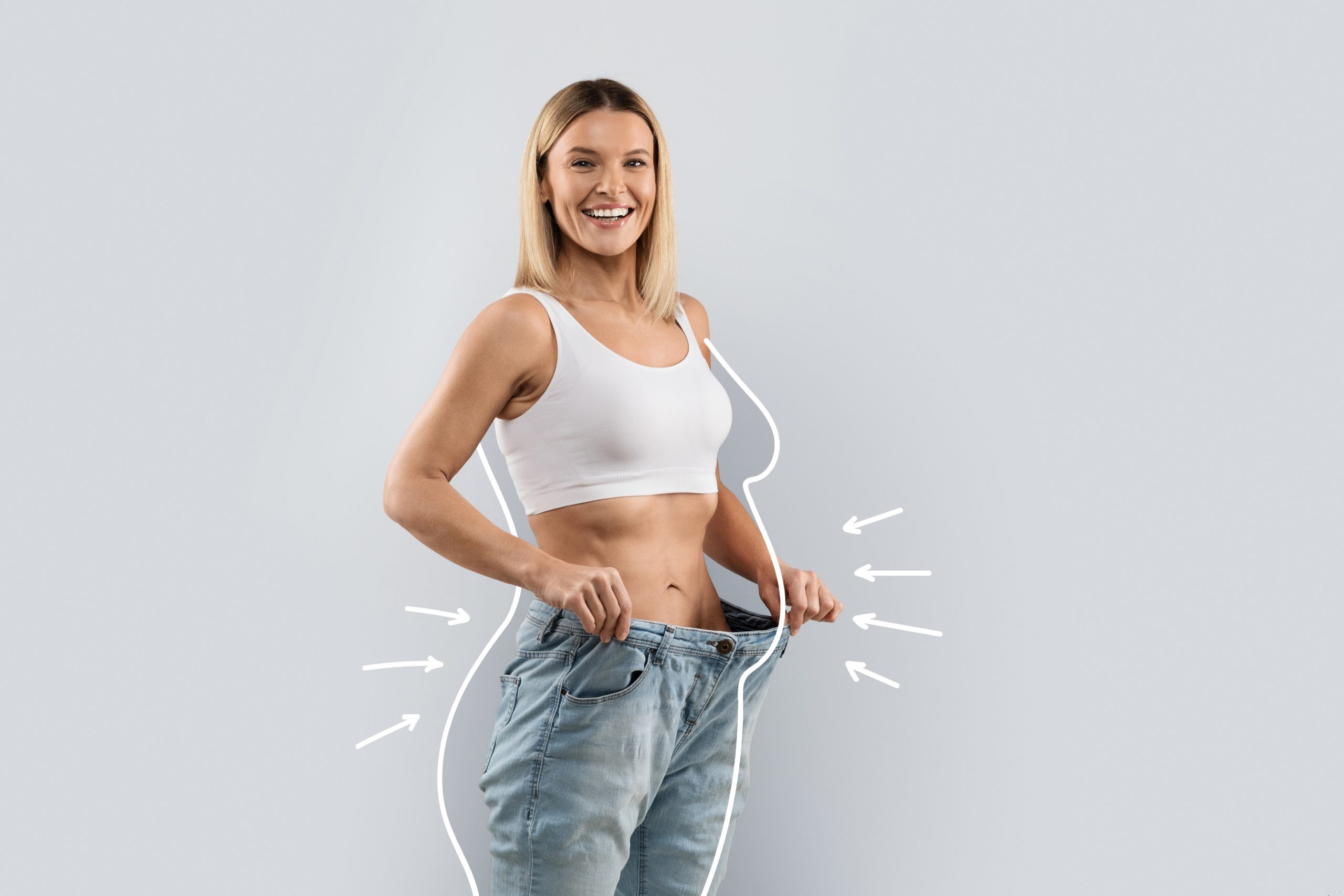 Gastric Plication