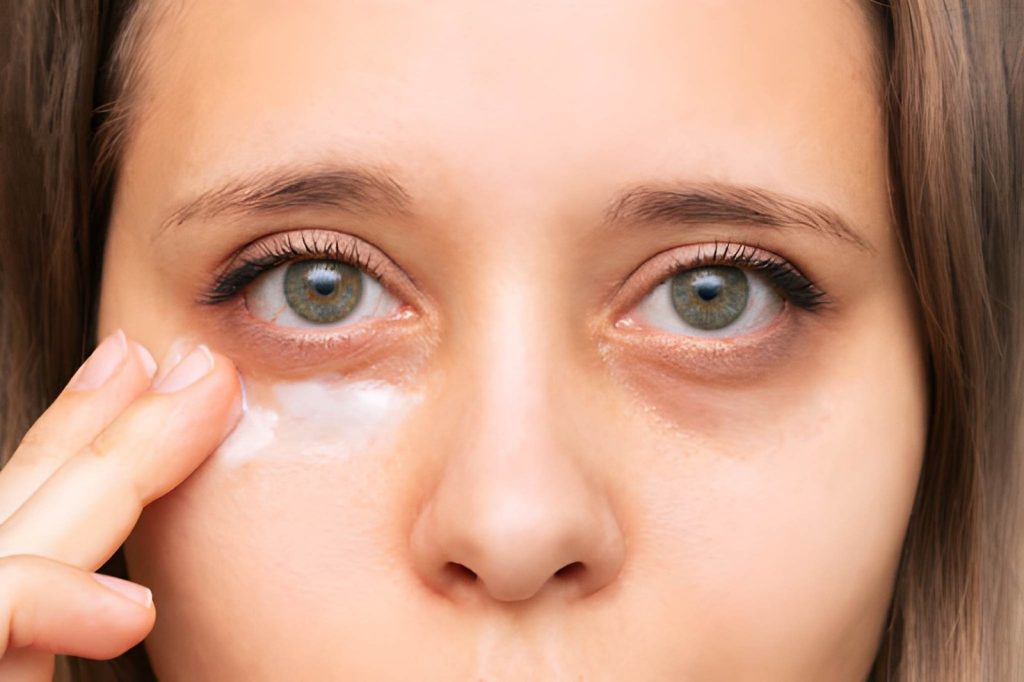 home remedies for eye bags