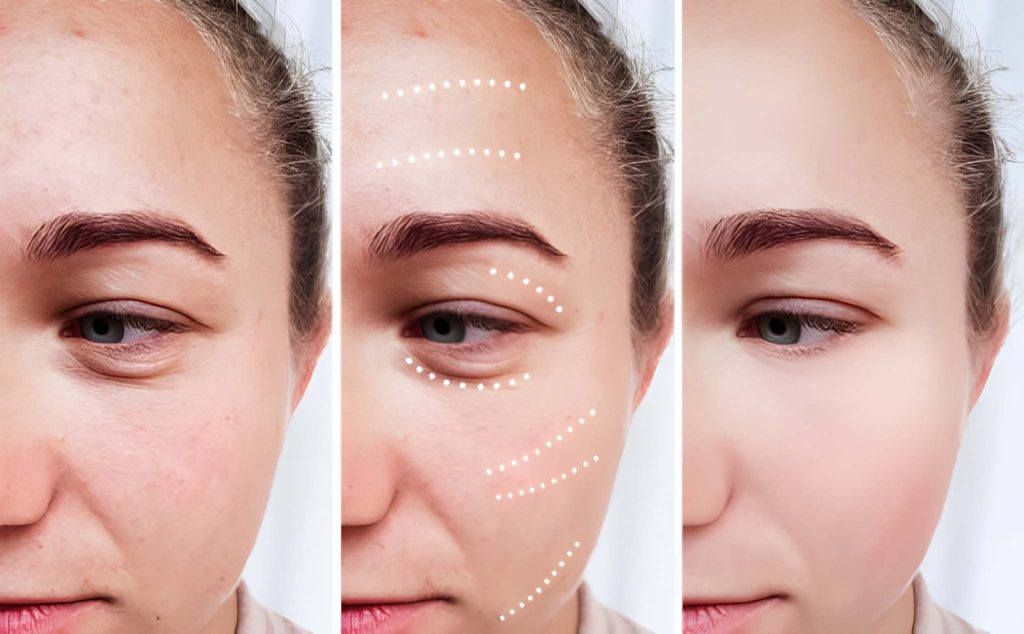 how to fix eye bags