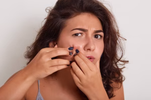 closed comedones treatment