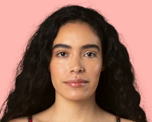 Facial Asymmetry