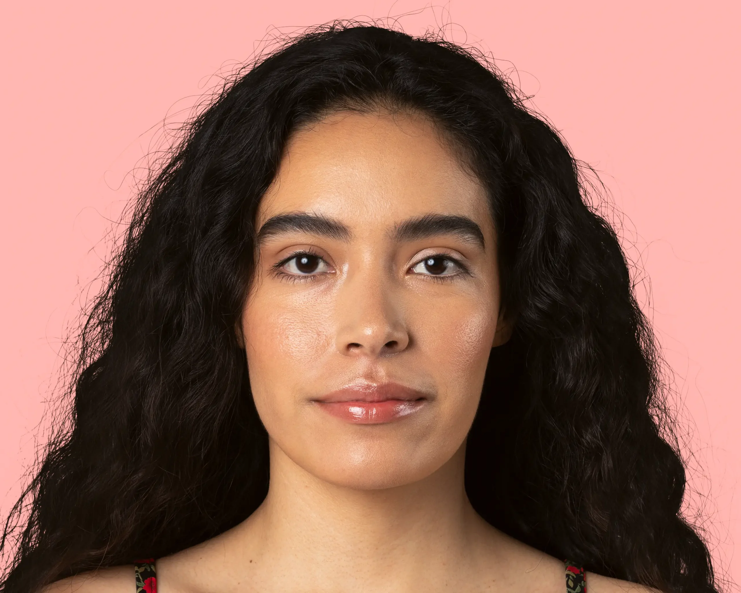 Facial Asymmetry