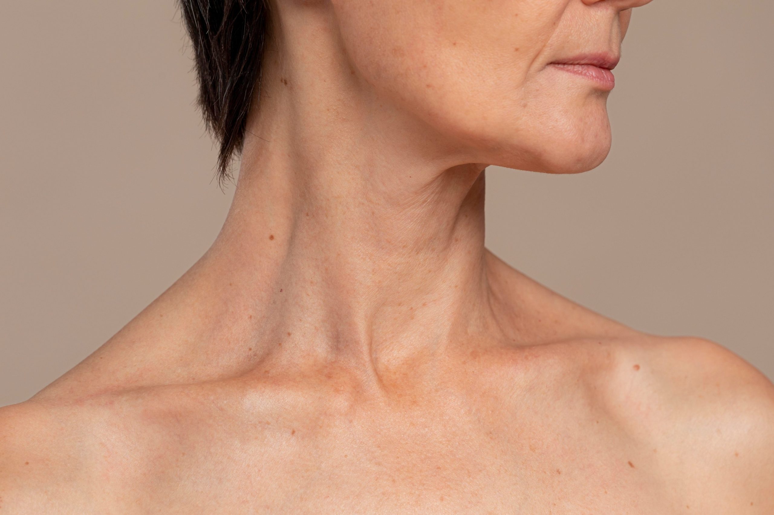 how to fix turkey neck