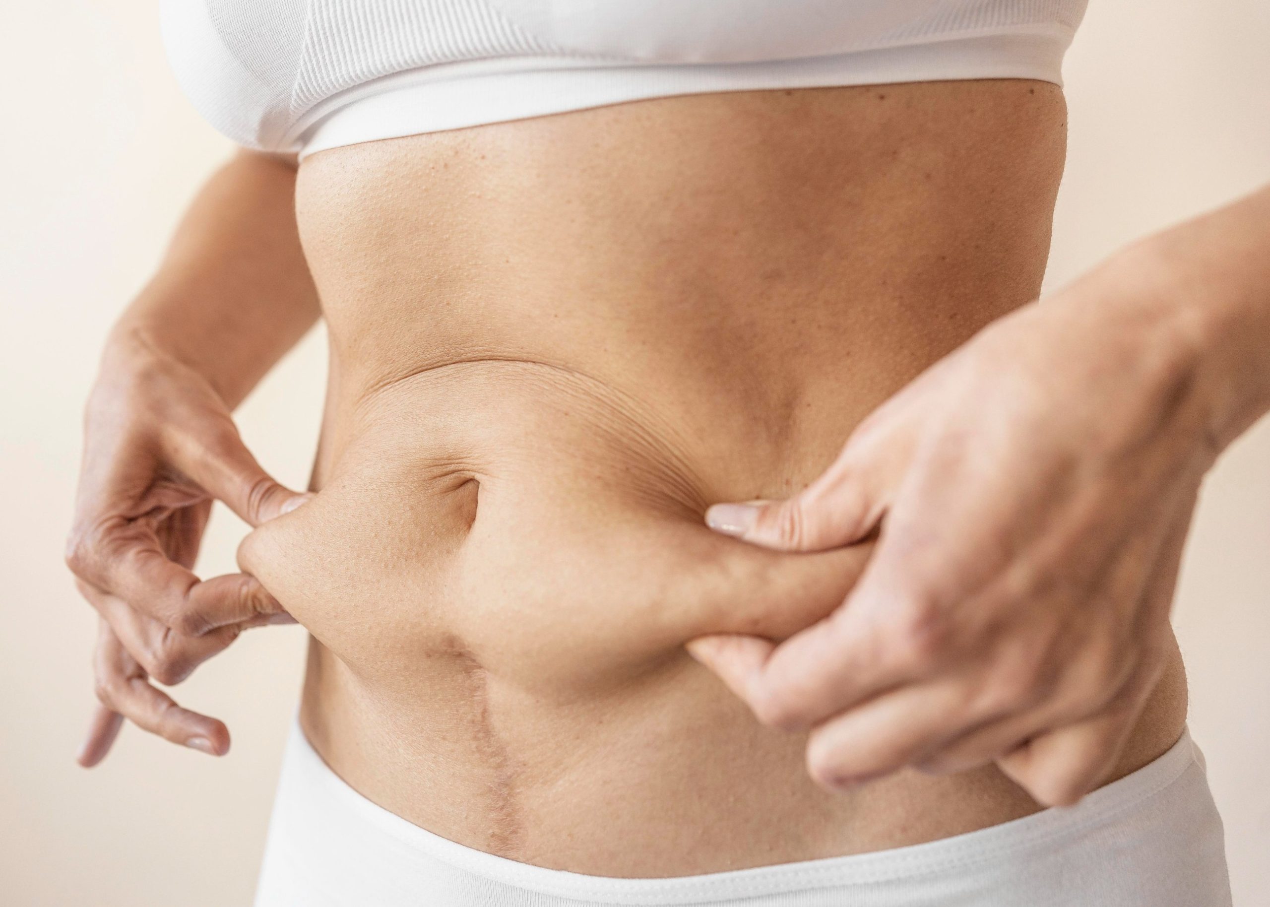 panniculectomy vs abdominoplasty